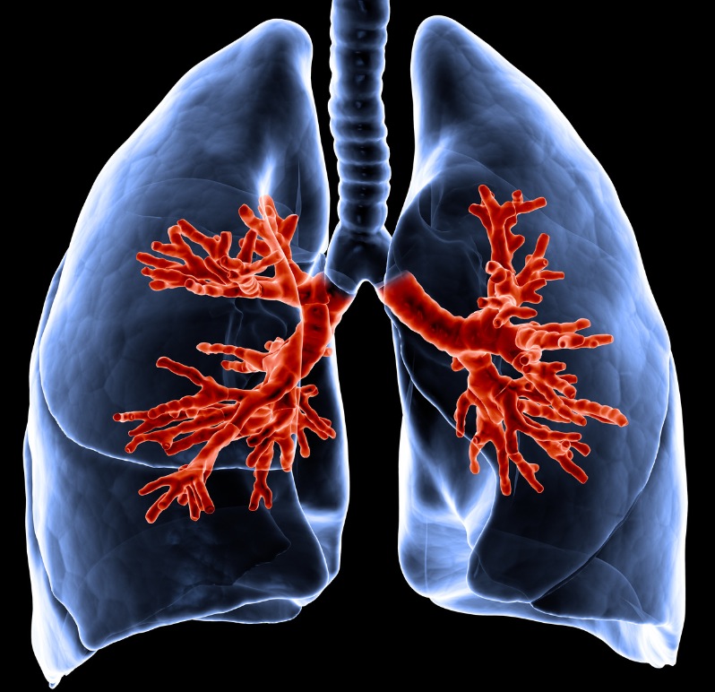 Lhypertension artérielle pulmonaire OPA Pratique